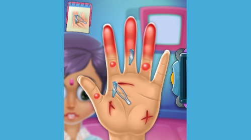 손 상처 치료하기 게임 (HAND DOCTOR)